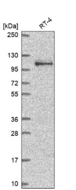 ARVCF Antibody, Novus Biologicals:Antibodies:Primary Antibodies
