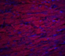 ASAH1 Antibody - BSA Free, Novus Biologicals 0.1mg; Unlabeled:Antibodies,