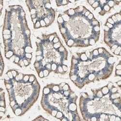 ASAH1 Antibody, Novus Biologicals 0.1mL; Unlabeled:Antibodies, Polyclonal