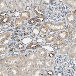 ASAH1 Antibody, Novus Biologicals 0.1mL; Unlabeled:Antibodies, Polyclonal