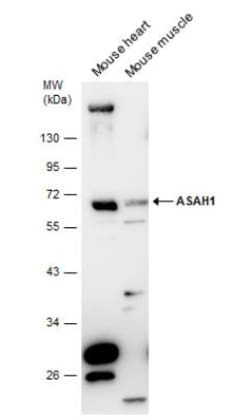 ASAH1 Antibody, Novus Biologicals 0.1mL; Unlabeled:Antibodies, Polyclonal