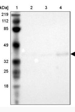 anti-ASB11, Polyclonal, Novus Biologicals 0.1mL; Unlabeled:Antibodies,