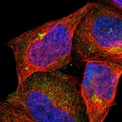 ASB7 Antibody, Novus Biologicals 0.1mL; Unlabeled:Antibodies, Polyclonal