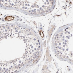 ASB7 Antibody, Novus Biologicals 0.1mL; Unlabeled:Antibodies, Polyclonal