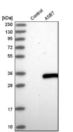 ASB7 Antibody, Novus Biologicals 0.1mL; Unlabeled:Antibodies, Polyclonal