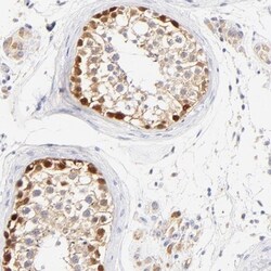 ASB9 Antibody, Novus Biologicals:Antibodies:Primary Antibodies