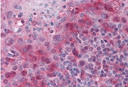 ASC/TMS1 Antibody, Novus Biologicals 0.10 miligramo | Buy Online | Novus Biologicals | Fisher Scientific