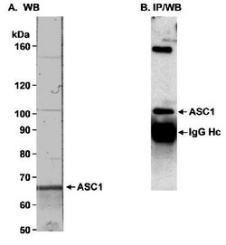 ASC1 Antibody, Novus Biologicals 0.1mL; Unlabeled:Antibodies, Polyclonal