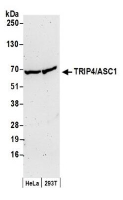 ASC1 Antibody, Novus Biologicals 0.1mL; Unlabeled:Antibodies, Polyclonal