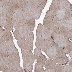 ASCC3 Antibody, Novus Biologicals 25 &mu;L | Buy Online | Novus Biologicals | Fisher Scientific