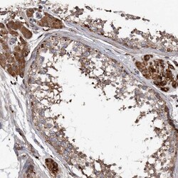 ASCC3 Antibody, Novus Biologicals 25 &mu;L | Buy Online | Novus Biologicals | Fisher Scientific
