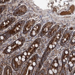 ASCC3 Antibody, Novus Biologicals:Antibodies:Primary Antibodies