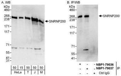 ASCC3L1 Antibody, Novus Biologicals 0.1mg; Unlabeled:Antibodies, Polyclonal