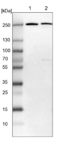 ASCC3L1 Antibody, Novus Biologicals:Antibodies:Primary Antibodies