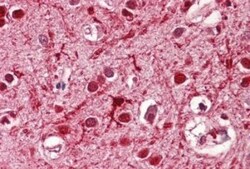 ASCL3 Antibody, Novus Biologicals 0.1mg; Unlabeled:Antibodies, Polyclonal