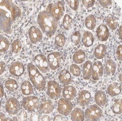ASCL3 Antibody, Novus Biologicals:Antibodies:Primary Antibodies