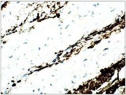 ASF1a Antibody, Novus Biologicals 100 &mu;g; Unconjugated:Antibodies, Polyclonal