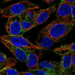 ASGPR1 Antibody, Novus Biologicals 0.1mL; Unlabeled:Antibodies, Polyclonal