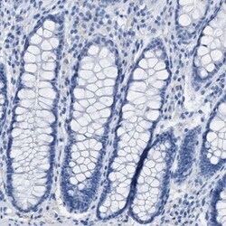 ASGPR1 Antibody, Novus Biologicals 0.1mL; Unlabeled:Antibodies, Polyclonal