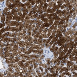 ASGPR1 Antibody, Novus Biologicals 0.1mL; Unlabeled:Antibodies, Polyclonal