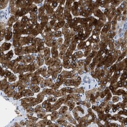 ASGPR1 Antibody, Novus Biologicals 25 &mu;L; Unlabeled:Anticorps, Polyclonal