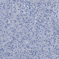 ASGPR1 Antibody, Novus Biologicals 25 &mu;L; Unlabeled:Anticorps, Polyclonal