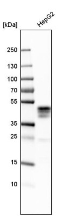 ASGPR1 Antibody, Novus Biologicals 25 &mu;L; Unlabeled:Anticorps, Polyclonal