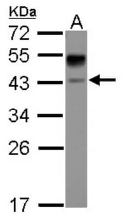 ASGPR1 Antibody, Novus Biologicals 0.1mL; Unlabeled:Antibodies, Polyclonal