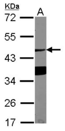 ASGPR1 Antibody, Novus Biologicals 0.1mL; Unlabeled:Antibodies, Polyclonal