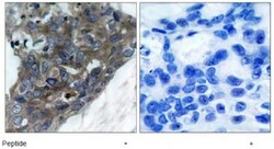 ASK1 Antibody, Novus Biologicals:Antibodies:Primary Antibodies