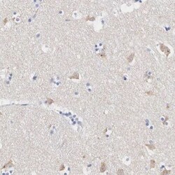 ASPHD2 Antibody, Novus Biologicals 0.1 mL | Buy Online | Novus Biologicals | Fisher Scientific