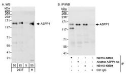 ASPP1 Antibody, Novus Biologicals 0.1mg; Unlabeled:Antibodies, Polyclonal
