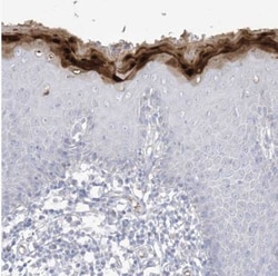 ASPRV1 Antibody, Novus Biologicals 0.1 mL | Buy Online | Novus Biologicals | Fisher Scientific