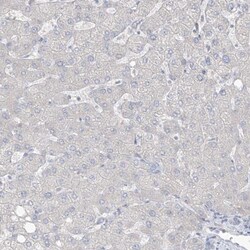 ASPRV1 Antibody, Novus Biologicals 0.1 mL | Buy Online | Novus Biologicals | Fisher Scientific
