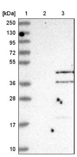ASPRV1 Antibody, Novus Biologicals 0.1 mL | Buy Online | Novus Biologicals | Fisher Scientific