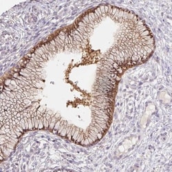 ASRGL1 Antibody, Novus Biologicals 0.1mL; Unlabeled:Antibodies, Polyclonal