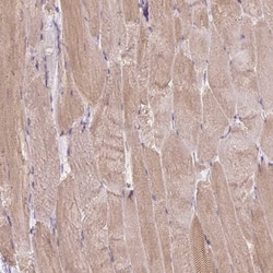 ASRGL1 Antibody, Novus Biologicals 0.1mL; Unlabeled:Antibodies, Polyclonal