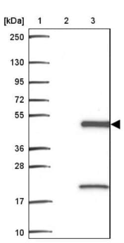 ASRGL1 Antibody, Novus Biologicals 0.1mL; Unlabeled:Antibodies, Polyclonal