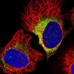 ASTE1 Antibody, Novus Biologicals 25 &mu;L; Unlabeled:Antibodies, Polyclonal