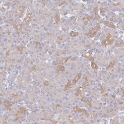 ASTE1 Antibody, Novus Biologicals 25 &mu;L; Unlabeled:Antibodies, Polyclonal