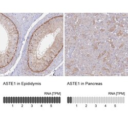 ASTE1 Antibody, Novus Biologicals 25 &mu;L; Unlabeled:Antibodies, Polyclonal