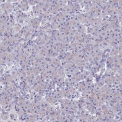 ASTE1 Antibody, Novus Biologicals 0.1 mL | Buy Online | Novus Biologicals | Fisher Scientific