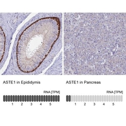 ASTE1 Antibody, Novus Biologicals 0.1 mL | Buy Online | Novus Biologicals | Fisher Scientific