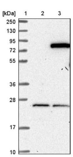 ASTE1 Antibody, Novus Biologicals 25 &mu;L; Unlabeled:Antibodies, Polyclonal
