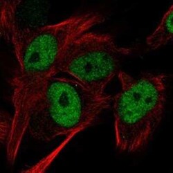 ASUN Rabbit anti-Human, Polyclonal, Novus Biologicals 100 &mu;g; Unconjugated:Antibodies,