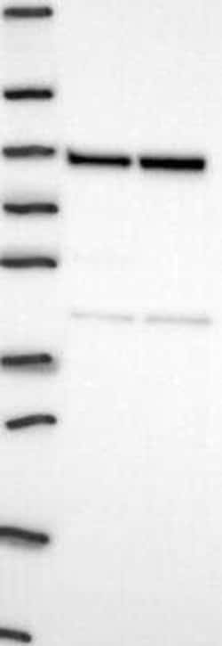 ASUN Rabbit anti-Human, Polyclonal, Novus Biologicals 100 &mu;g; Unconjugated:Antibodies,