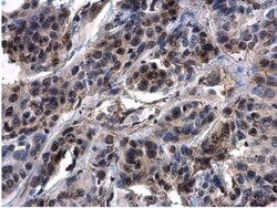 ASXL1 Antibody, Novus Biologicals 0.1mL:Antibodies, Polyclonal