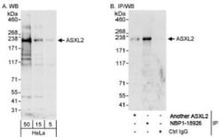 ASXL2 Antibody, Novus Biologicals 100 &mu;L | Buy Online | Novus Biologicals | Fisher Scientific