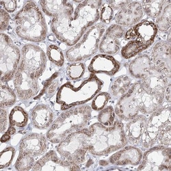 ATAD1 Antibody, Novus Biologicals 0.1mL; Unlabeled:Antibodies, Polyclonal