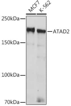 ATAD2 Rabbit anti-Human, Clone: 2K7T2, Novus Biologicals 100 &mu;g | Buy Online | Novus Biologicals | Fisher Scientific